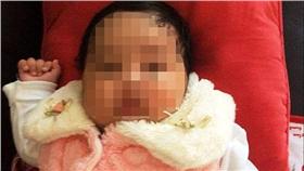 澳洲難民女嬰遭燙傷（圖／翻攝自Daily Mail）