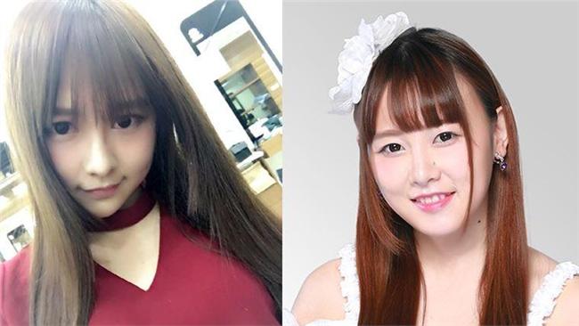 SNH48唐安琪用打火機不慎遭火吻