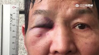 4點不收報　送報生硬闖社區痛毆保全