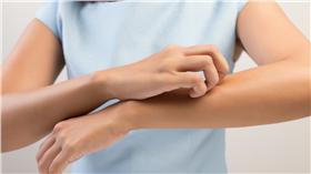 過敏皮膚癢（shutterstock／達志影像）