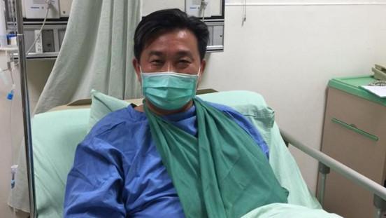 王定宇不慎撞斷鎖骨　緊急送醫動手術