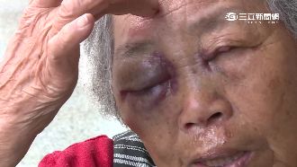 酒駕撞傷老夫婦　男子竟企圖殺人滅口