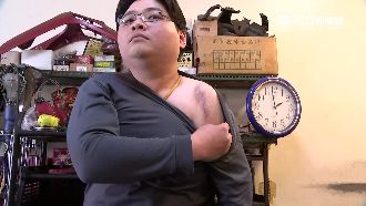 男癲癇送醫撞成骨折　訴請國賠竟敗訴