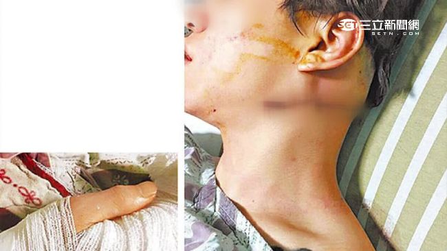 不爽嫩妻被虧　醋夫怒將情敵砍成重傷