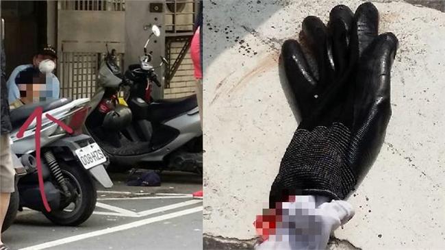 鋸傷消毒人員　兇嫌竟稱要救「小強」