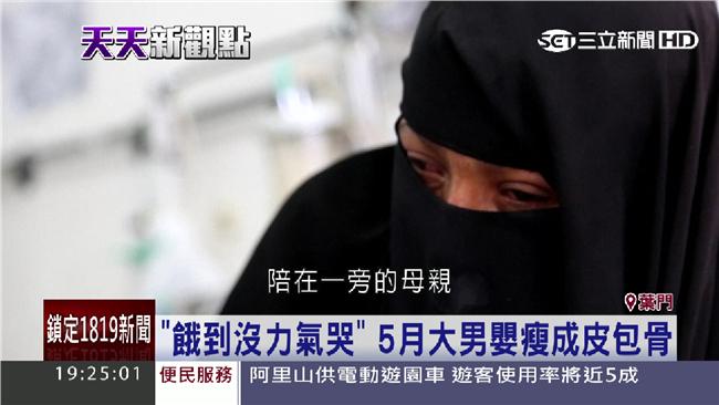 葉門內戰悲歌！母眼睜睜看5月兒餓死