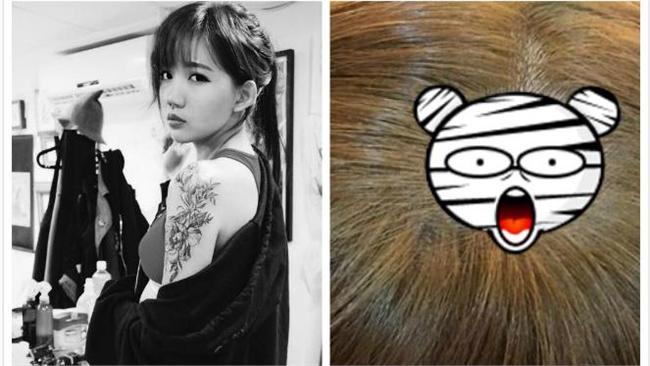 丈夫偷腥壓力大？女藝人頭頂現圓形禿