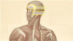 名家黃偉俐提供-偏頭痛