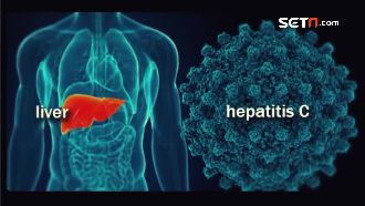 C肝患者福音！新藥治癒率高達9成