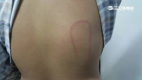 f師繩打病兒1100