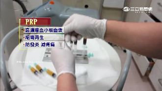 PRP終結疼痛？醫美「鑽漏洞」濫用