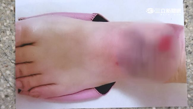 獨／知名烏龍麵打翻湯　遭控拖延賠償