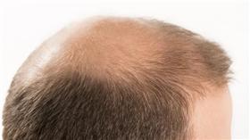 ▲圖／shutterstock／達志影像