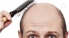 禿頭（圖／翻攝自YouTube）