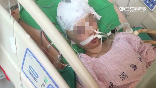 獨家 待轉遇橫禍 女遭拖行重傷頭蓋骨待重建 社會 三立新聞網setn Com