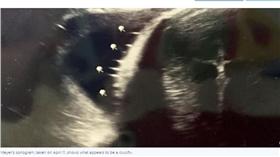 超音波照到耶穌！　美21歲辣媽：這是「聖的介入」。（圖／翻攝自abc News）