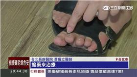 搶救灰指甲　（業配）