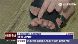 跟灰指甲說掰掰　靠這幾招輕鬆解決