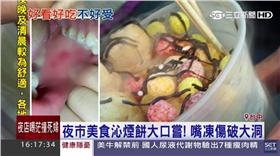 夜市美食「沁煙餅」大口嚐　嘴凍傷破大洞