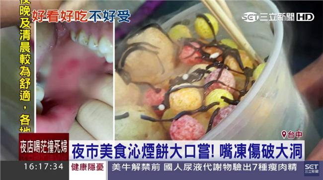 男吃沁煙餅遭凍傷　嘴巴流血破大洞