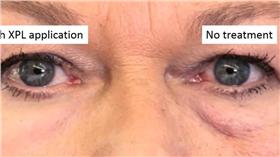 第二肌膚,眼袋,皺紋,圖／MIT News