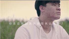 八仙塵爆、燒燙傷、陽光基金會、傷疤（圖／翻攝自陽光基金會）