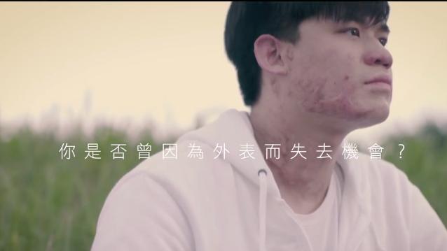 燒燙傷患者租屋碰壁！房東譏影響房價