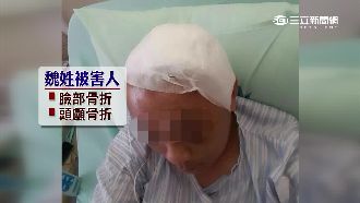 「被瞪不爽」！男撿鐵棍狠砸路人頭