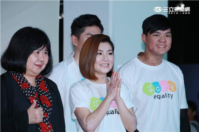 20160513-Selina（右）出席陽光基金會臉部平權特展