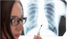 肺癌,二手菸,抽菸,吸菸,斷層檢查,女性,男性,老菸槍