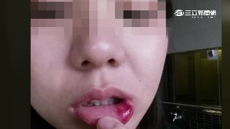 搭北捷不滿被擋！男怒揮拳女乘客