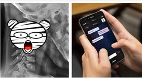 頸椎錯位/萬家資訊
低頭族,手機/達志影像／美聯社