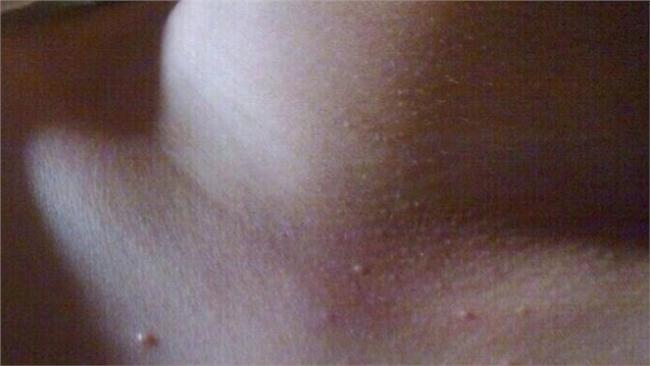 讓人羞羞臉的「小肉芽」究竟是？