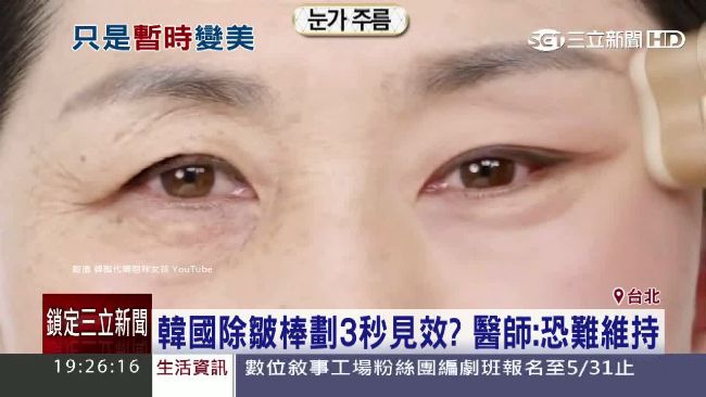 韓除皺棒3秒見效　醫師解密是暫時的