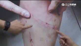 特教生遭電擊？　學校：拿電蚊拍嚇阻