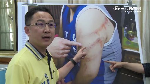 "電擊棒"管教特教生!? 校方:電蚊拍嚇阻