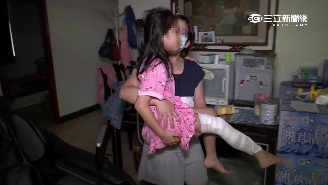 水溝蓋吃人！10歲女童踩空傷口見骨