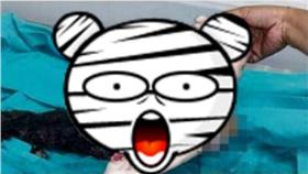 有圖慎入！15歲少年腹中取出長髮怪胎／中國報
http://goo.gl/8X1gu2