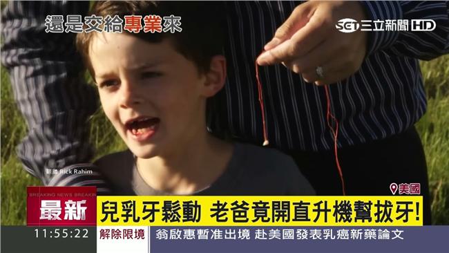 飛行員爸出奇招　開直升機幫兒子拔牙