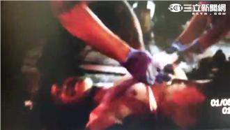 女友酒後暴走　男遭砍傷又持毒被逮