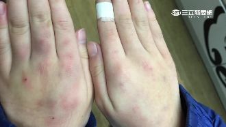 男童遭拿尺割頸、逼跪　離譜師竟漠視