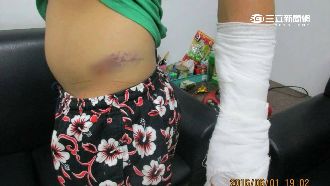 不滿曾被丟垃圾　5男隨機找外勞痛毆