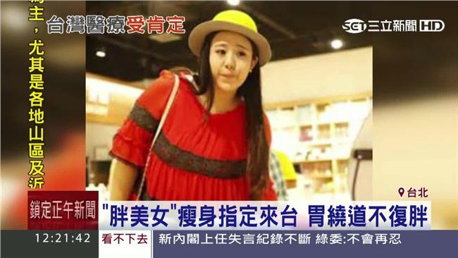 胖美女來台求瘦身　胃繞道手術不復胖