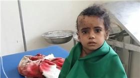 無國界醫生／戰鬥重擊塔伊茲　一天內122人重傷