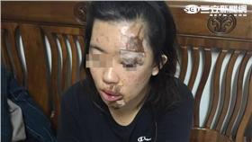 路基淘空 女騎車慘摔