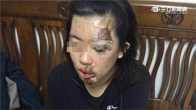 慘! 路基淘空 女騎車摔成這樣