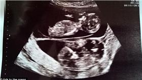 圖／翻攝自每日郵報