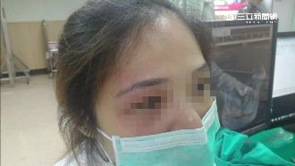 不滿護理師咆哮　病患家屬竟扯髮揮拳