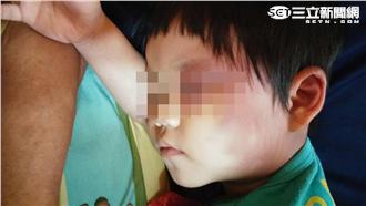 父被擋土牆壓死　3歲女兒又遭虐