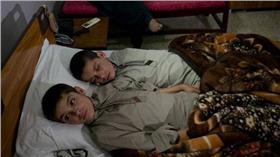 巴基斯坦怪病（圖／翻攝自Día Perfecto Twitter）